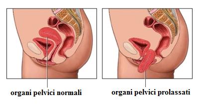 Pavimento pelvico